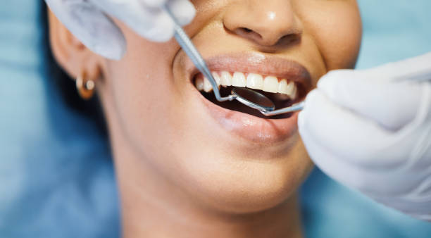 Best Emergency Dental Care for Broken or Chipped Teeth in Wayne Heights, PA