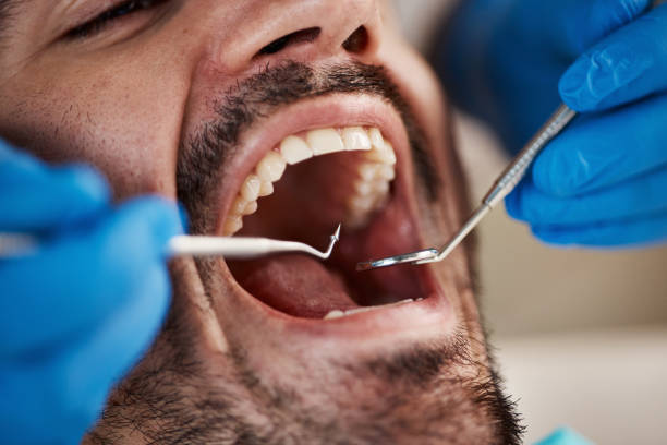 Best Emergency Dental Care for Broken or Chipped Teeth in Wayne Heights, PA